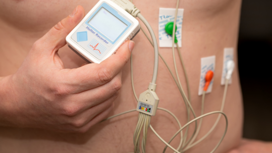 HOLTEROVSKÁ MONITORACE EKG NA 24 HODIN