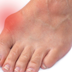 HALLUX VALGUS, ANEB LODIČKY NEBO ŽABKY?
